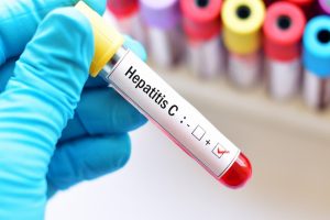 कोरोनावायरस पर एक और दावा, हेपेटाइटिस-C की दवा खाने वाले मरीजों पर नहीं हो रहा इसके संक्रमण का असर!