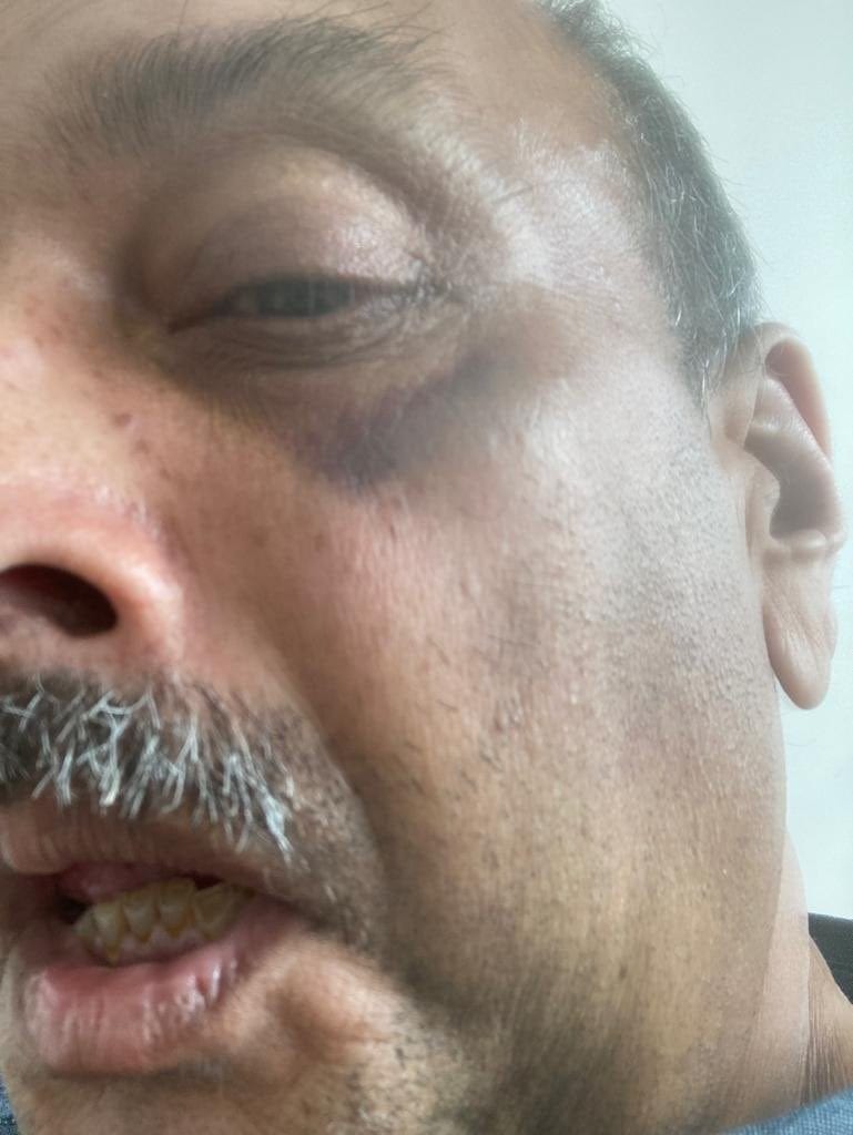Mehul Choksi