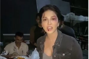 Sunny Leone: चोट के निशान के साथ नजर आईं सनी लियोनी, वीडियो हो रहा वायरल, जानें सच्चाई