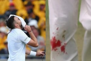 Ind vs Eng: बहता रहा खून…फिर भी करते रहे गेंदबाजी, जेम्स एंडरसन के जज्बे को देख फैंस ने किया सलाम
