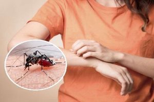 Dengue: किस समय ज्यादा काटते हैं डेंगू के मच्छर, जानें लक्षण-इलाज और बचाव