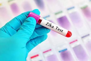 Zika Virus: यूपी में बढ़ रहा जीका वायरस का संक्रमण! मरीजों के लिए लखनऊ में  बनाए जाएंगे कंटेनमेंट जोन
