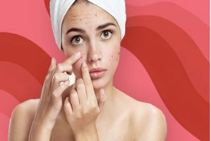 Skin Care Tips: आसानी से पाना चाहते है पिंपल से निजात तो अपनाए ये घरेलु उपचार