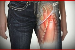 Skinny Jeans Side Effects: टाइट जींस पहनने वाले ध्यान दें, हो सकती हैं ये 5 गंभीर बीमारियां