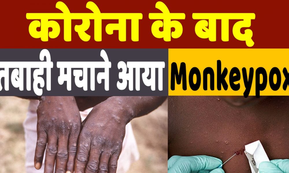 What is Monkeypox: Monkeypox से बढ़ी दहशत, कितनी खतरनाक है ये बीमारी, क्या हैं लक्षण और इलाज