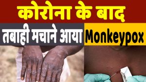 What is Monkeypox: Monkeypox से बढ़ी दहशत, कितनी खतरनाक है ये बीमारी, क्या हैं लक्षण और इलाज
