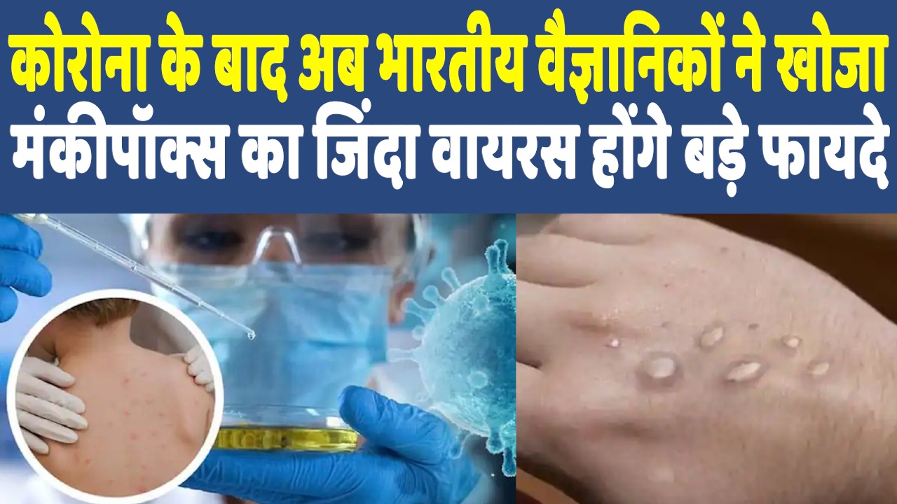 Monkeypox in India: भारतीय वैज्ञानिकों ने ढूंढा मंकीपॉक्स का जिंदा वायरस