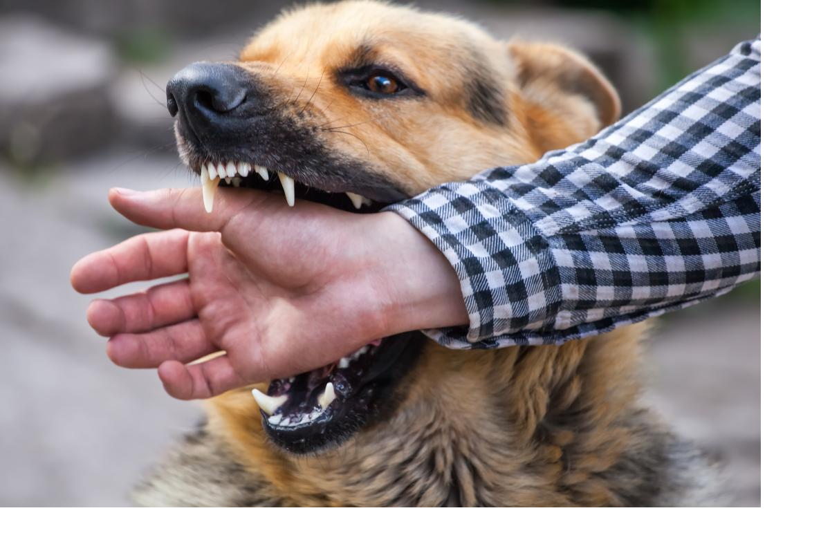 Dog Bite Treatment: अगर कभी काट ले कुत्ता तो बिना देर किए करें ये काम, नहीं तो हो सकती है रैबीज की बीमारी