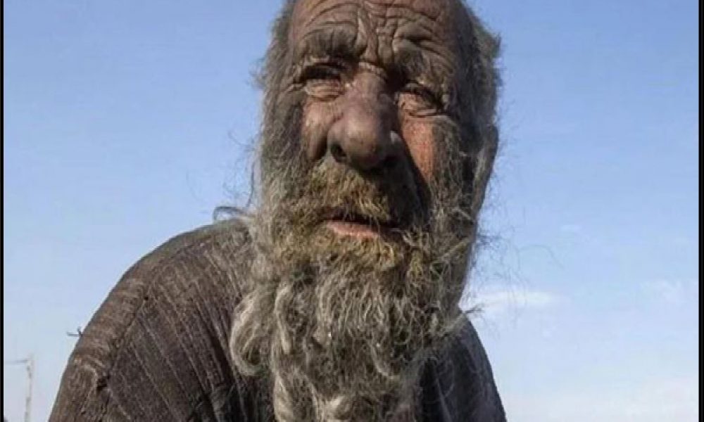 Dirtiest Man: दुनिया की सबसे गंदे आदमी अमौ हाजी का निधन, नहाने से लगता था डर, 60 साल से अधिक समय से पानी को नहीं लगाया हाथ