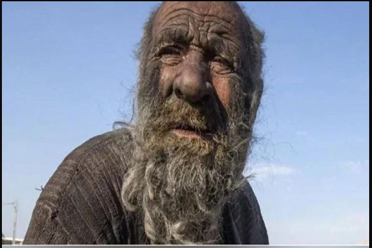Dirtiest Man: दुनिया की सबसे गंदे आदमी अमौ हाजी का निधन, नहाने से लगता था डर, 60 साल से अधिक समय से पानी को नहीं लगाया हाथ