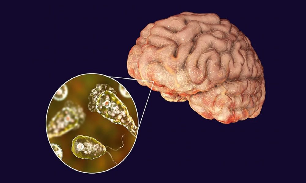 What Is Brain Eating Amoeba In Hindi: क्या है ब्रेन ईटिंग अमीबा? जिसके 3 मरीजों की केरल में हो चुकी है मौत और चौथा अस्पताल में भर्ती