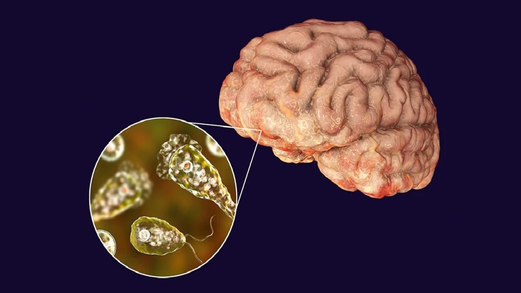 naegleria fowleri Brain eating amoeba 1