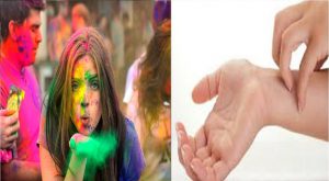 Holi Skin Care 2023: रंगों की वजह से स्किन हो गई है खराब तो इन देसी नुस्खों से घर बैठे करें इलाज