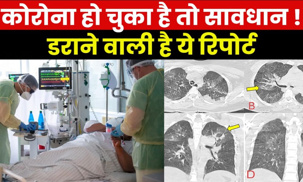 Cardiac Arrest cases increased after Covid: कोरोना के बाद कार्डियक अरेस्ट के मामलों मे 38% का इजाफा