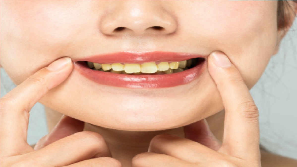 Tips For Healthy Teeth: दांतों पर जम गई है पीली-गाढ़ी परत, जानें कैसे ये लेयर दांतों को कर देती है बर्बाद