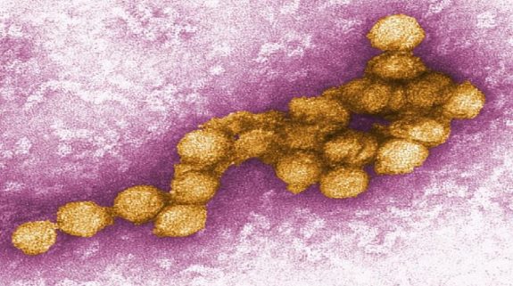 What Is West Nile Virus In Hindi: क्या है वेस्ट नाइल वायरस, जिसके केरल में मिल रहे मरीज; जानिए कितना खतरनाक और क्या होते हैं लक्षण