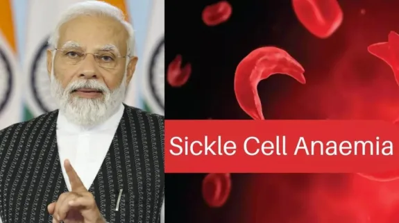 What Is Sickle Cell Anemia Disease In Hindi? : क्या होती है सिकल सेल एनीमिया की बीमारी? जिससे परेशान है आदिवासी समाज, पीएम नरेंद्र मोदी ने जमुई रैली में किया जिक्र